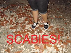 Scabies
